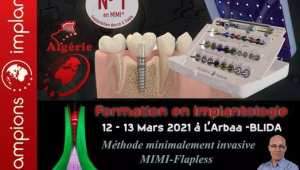 Mise à jour prothèse sur implants champions revolution et monobloc