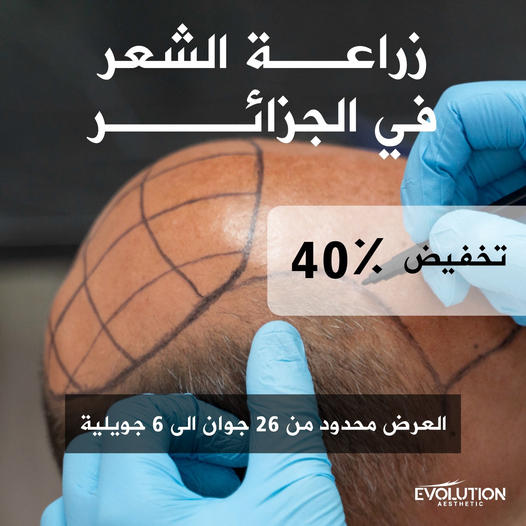 خصم خاص الفترة الحالية 40% زراعة الشعر في الجزائر 🇩🇿