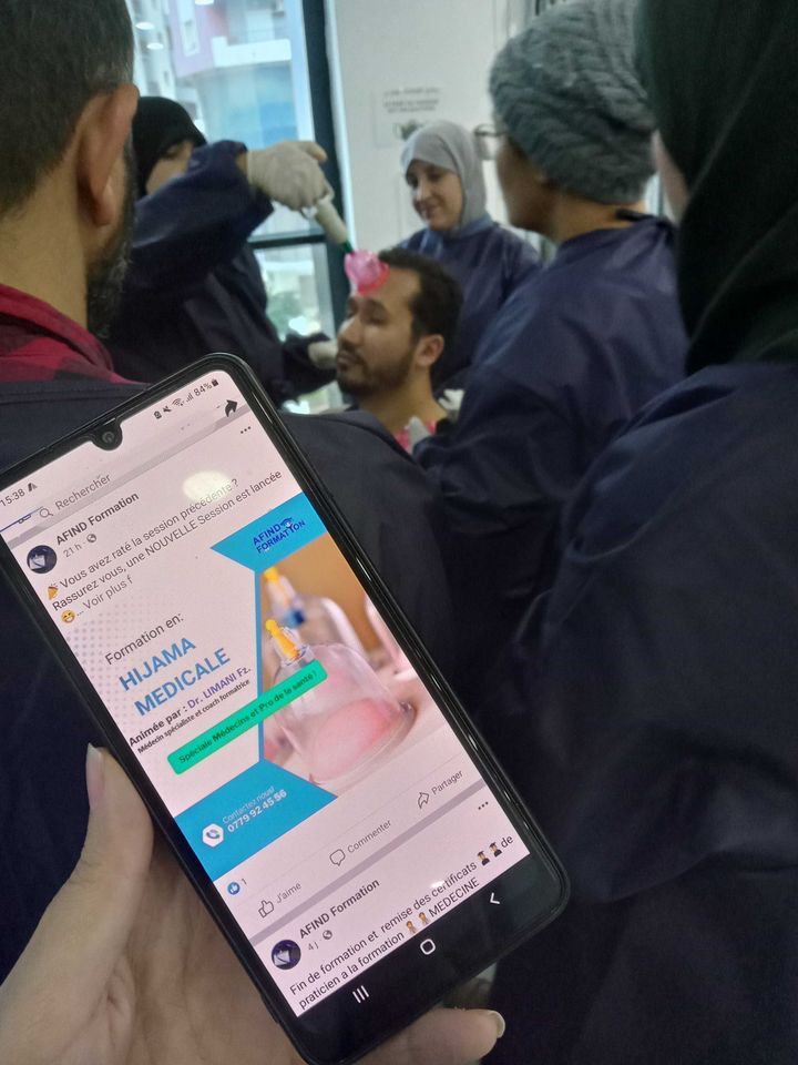 Formation pratique en Hijama Médicale !