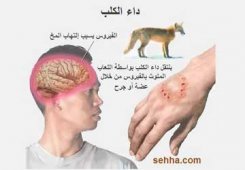 إصابة طفل بداء الكلب يفجر غضب المواطنين ببلدية بني راشد بالشلف