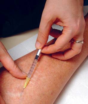 Lutte contre le cancer : la vitamine C, une nouvelle alternative selon les spécialistes Santé : les autres articles