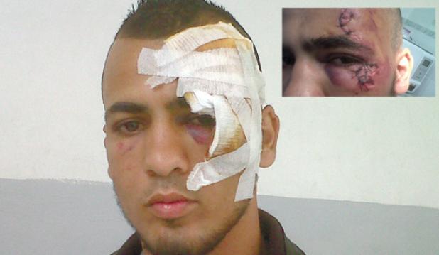 تسليط أقصى العقوبات على مولودية البويرة نجم أزفون يفوز على البساط