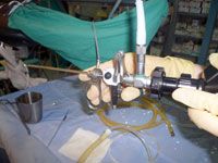 SETIF Journée internationale d'urologie pédiatrique