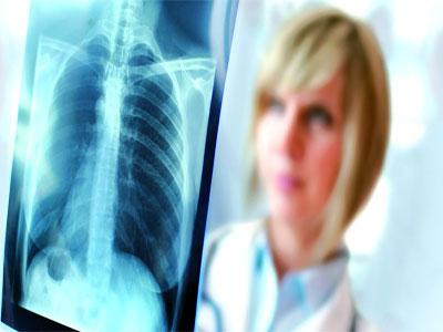 Les pouvoirs publics doivent s'engager concrètement dans la lutte contre les maladies non transmissibles Elles affectent négativement le développement dans le Continent africain