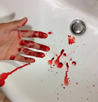 Journée mondiale de l'hémophilie : assurer une autonomie aux soins Santé : les autres articles