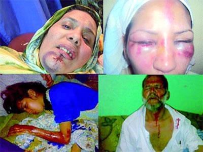 L'ONU interpellée pour l'élargissement de la Minurso à la surveillance des droits de l'Homme Conférence internationale de solidarité avec le peuple sahraoui