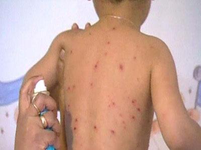 Les affections chez les enfants, souvent mal diagnostiquées Alors qu'en milieu les moyens manquent