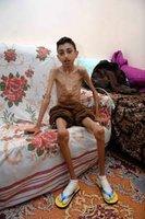 Bilal réclame de l'aide