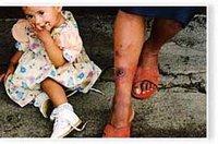 7784 cas au niveau national, plus de 49% à M'Sila