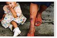 7784 cas au niveau national, plus de 49% à M'Sila