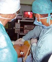 Extraction d'une lithiase urétrale par laparoscopie