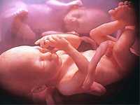 تفكيك شبكة في قضية حيازة وترويج مستحضرات معدة للإجهاض بوهران