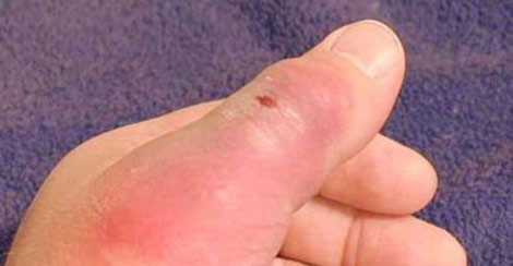 إصابة تلميذة بلسعة عقرب في حافلة نقل مدرسي بالوادي