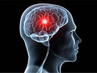 تسجيل 10 جلطات دماغية يوميا بالمركز الإستشفائي الجامعي لتلمسان