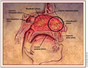 Que faire devant l'epistaxis de l'enfant (saignement du nez)