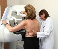 Dépistage du cancer du sein par la Cnas : Les spécialistes sont-ils mis à contribution '