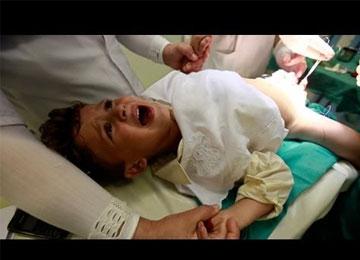 وهران تسجل تراجع عمليات الختان خارج المرافق الصحيةبفضل حملات التوعية المكثفة