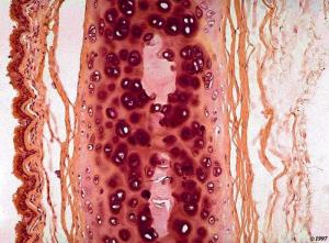 كلا إذا بلغت التراقي