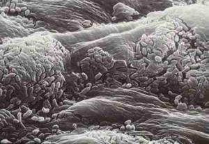 بلايين الجراثيم على جلدنا!