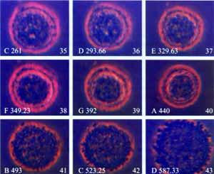 خلية سرطانية تم تفجيرها باستخدام الترددات الصوتية فقط