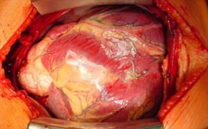 كثرة النوم والموت المفاجئ