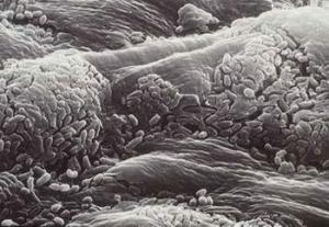 الجلد يتكلم ... سبحان الله!**2