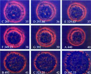خلية سرطانية تم تفجيرها باستخدام الترددات الصوتية فقط