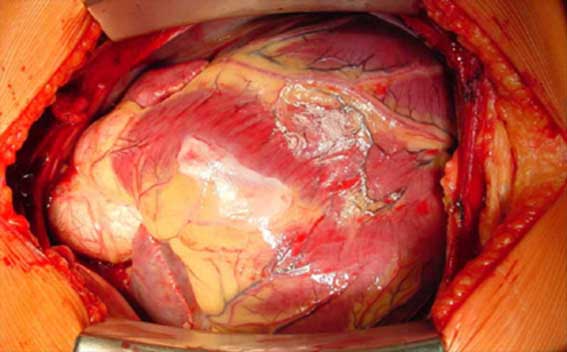 كثرة النوم والموت المفاجئ