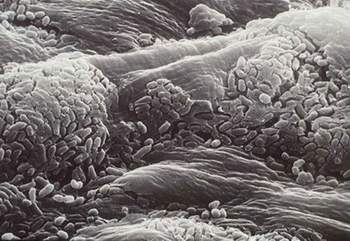 الجلد يتكلم ... سبحان الله!**2