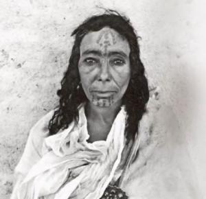 مخاطر ومضار الوشم من الجانب الصحي