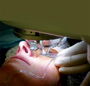 des centaines de malades risquent la cécitéL'importation des greffons de cornée suspendue depuis 2012