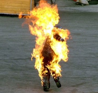 شاب يصارع الموت بعدما أضرم النار في جسده بوهران