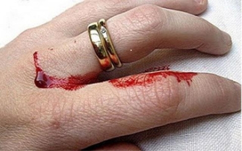 توقيف قاضم أصابع ضحاياه بعين الدفلى