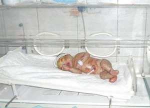 توقيف 13 مشبوها في قضايا إجهاض بمعسكر