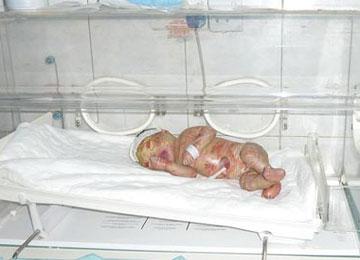 توقيف 13 مشبوها في قضايا إجهاض بمعسكر