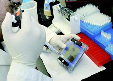 150 إصابة بالتهاب السحايا في البليدة