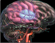AVC : ne plus réduire la pression artérielle à la phase aiguë ?