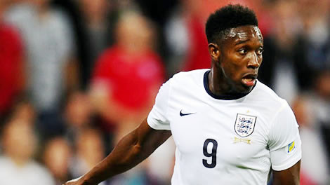 شكوك حول مشاركة الإنجليزي ويلبيك أمام إيطاليا