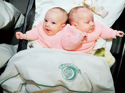 فصل التوأم الجزائري بالسعودية اليوم