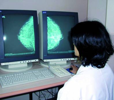 Inciter les femmes à se soumettre au test de dépistage