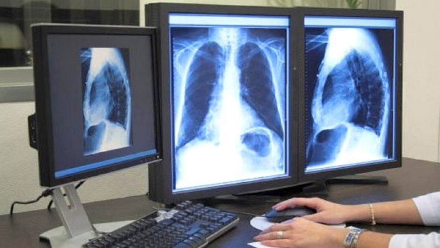 Lutte contre le tabagisme