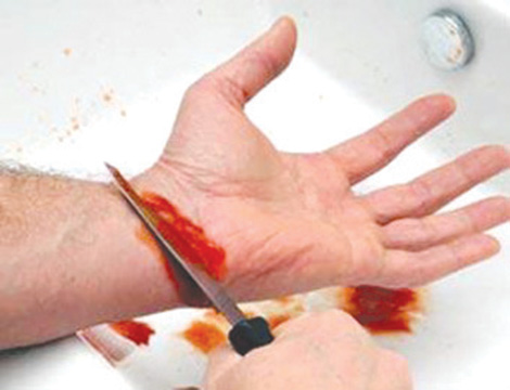 شاب يحاول الانتحار داخل مقر أمن دائرة القل بسكيكدة