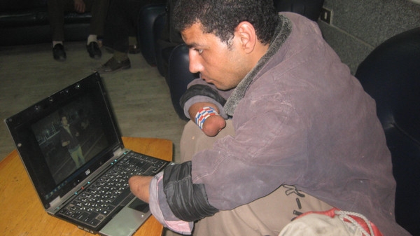 بالصور.. مصري يقطع يديه ليتوقف عن السرقة!