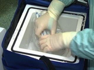 Le don d'organes doit être une pratique 