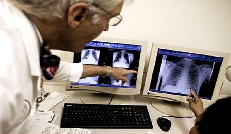 Près de 1.400 cas de tuberculose en 2014 à Sétif