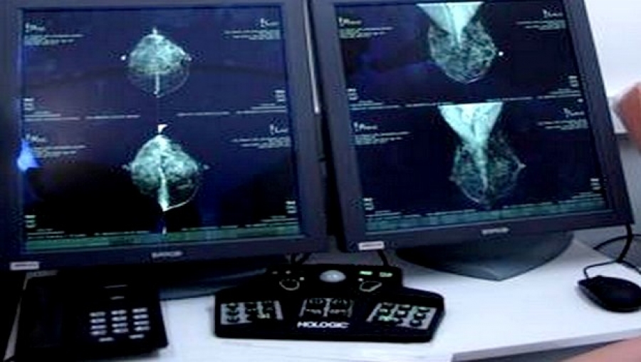 Les femmes sont les plus touchées par le cancer à Tissemsilt