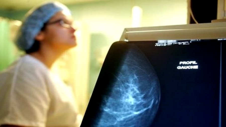 Cancer de sein et du col de l'utérus