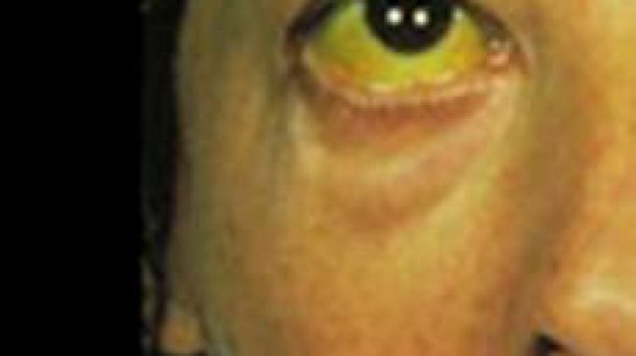 Les ictères, thème des journées médicochirurgicales de santé militaire à Constantine