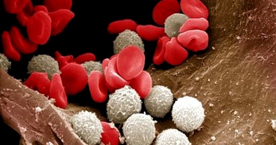 La thalassémie touche 2% de la population maghrébine