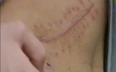 Une femme perd son rein dans une clinique privée à Sétif